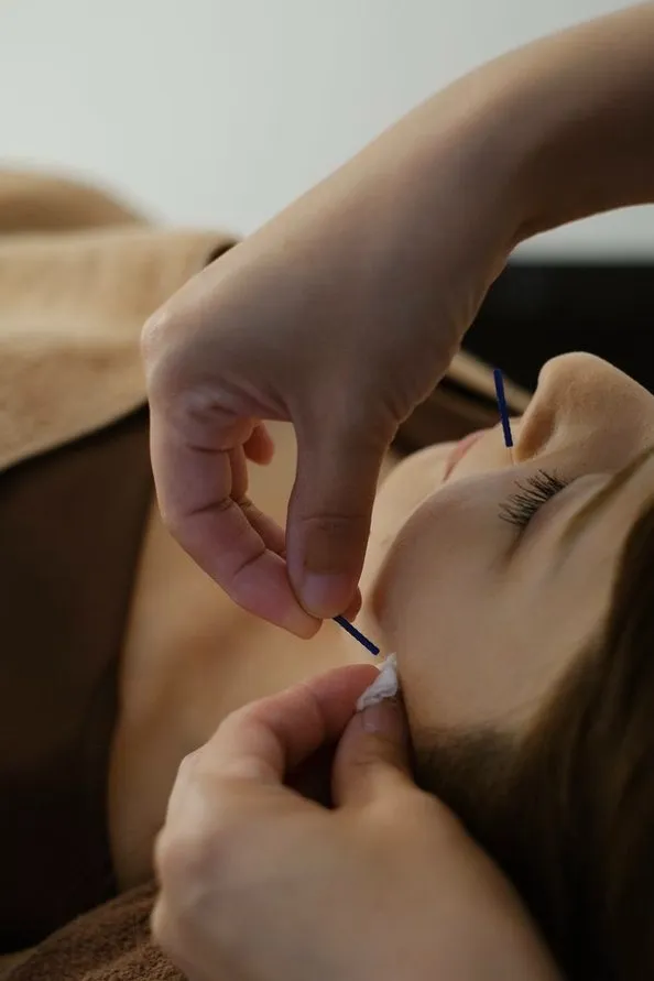 美容鍼の通院頻度は? 西宮市の女性専門鍼灸院『JJ夙川はり灸院』